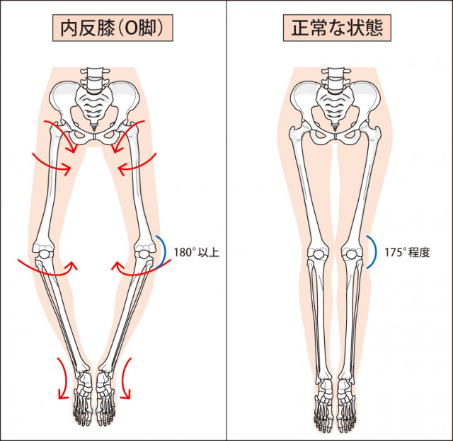 薬物療法